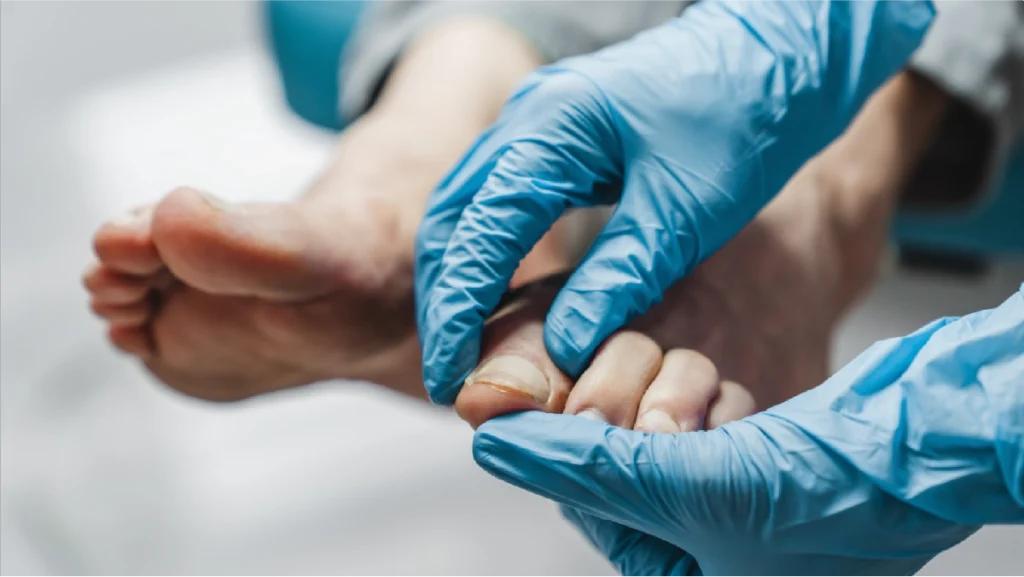 Dermatologia de tus pies