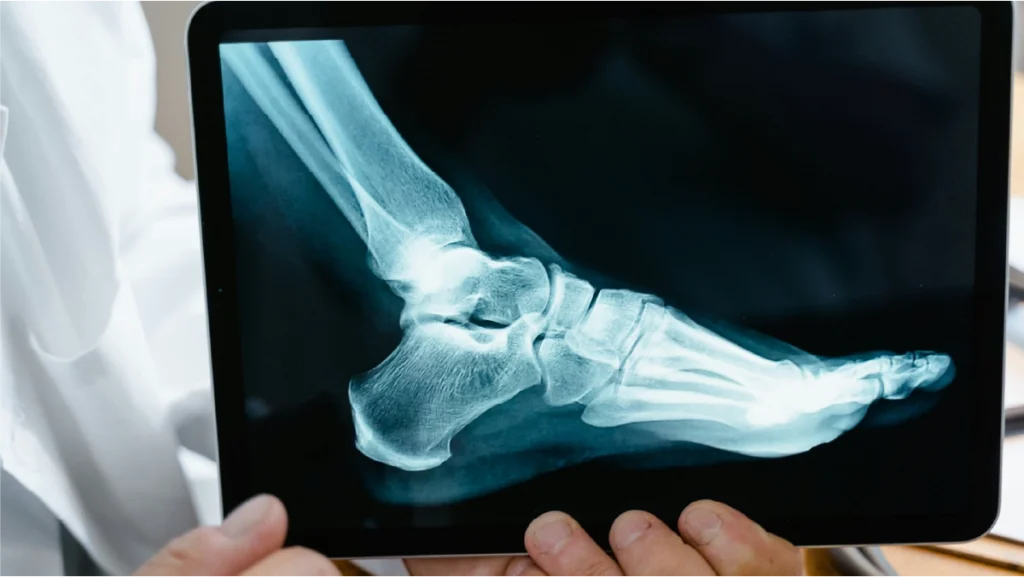 Radiografia Digital RX